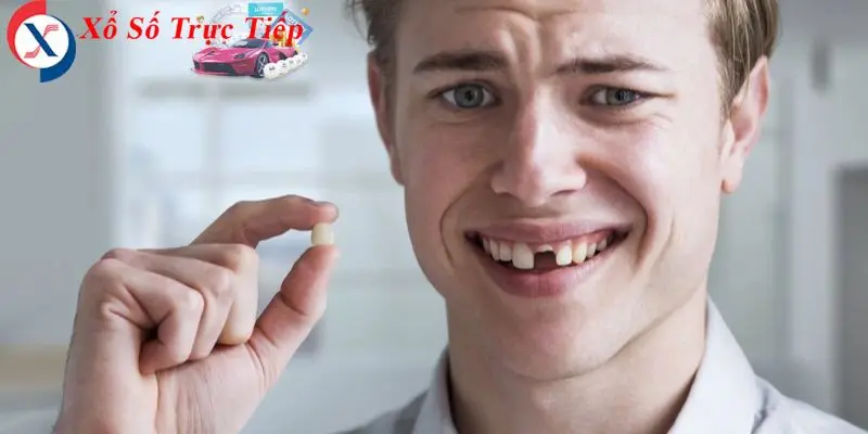 Những tình huống phổ biến khi mơ thấy rụng răng